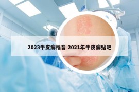 2023牛皮癬福音 2021年牛皮癬貼吧