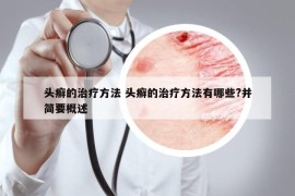 頭癬的治療方法 頭癬的治療方法有哪些?并簡(jiǎn)要概述