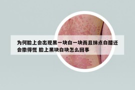 為何臉上會出現(xiàn)黑一塊白一塊而且抹點白醋還會撒得慌 臉上黑塊白塊怎么回事