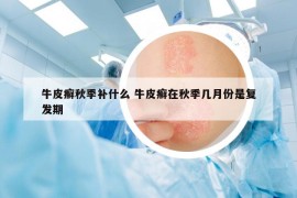 牛皮癬秋季補什么 牛皮癬在秋季幾月份是復發(fā)期