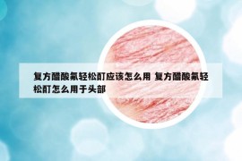 復方醋酸氟輕松酊應該怎么用 復方醋酸氟輕松酊怎么用于頭部