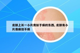 皮膚上長一小片類似于癬的東西, 皮膚有小片像癬但不癢