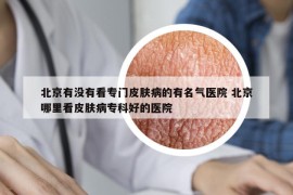 北京有沒(méi)有看專(zhuān)門(mén)皮膚病的有名氣醫(yī)院 北京哪里看皮膚病專(zhuān)科好的醫(yī)院