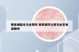 銀屑病能吃馬齒菜嗎 銀屑病可以用馬齒莧來濕敷嗎