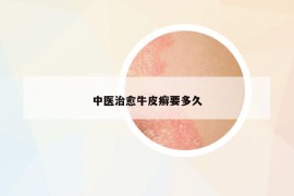 中醫(yī)治愈牛皮癬要多久