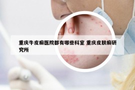 重慶牛皮癬醫(yī)院都有哪些科室 重慶皮膚癬研究所