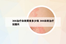 308治療白斑費用多少錢 308白斑治療儀圖片