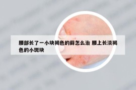 腰部長了一小塊褐色的蘚怎么治 腰上長淡褐色的小斑塊