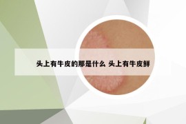 頭上有牛皮的那是什么 頭上有牛皮鮮