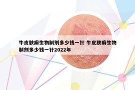 牛皮膚癬生物制劑多少錢一針 牛皮膚癬生物制劑多少錢一針2022年