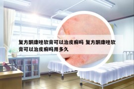 復(fù)方酮康唑軟膏可以治皮癬嗎 復(fù)方酮康唑軟膏可以治皮癬嗎用多久