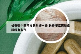 長春哪個醫(yī)院皮膚科好一些 長春哪家醫(yī)院皮膚科有名氣