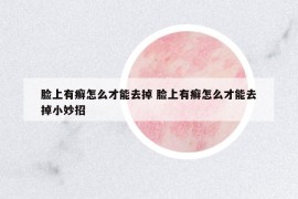 臉上有癬怎么才能去掉 臉上有癬怎么才能去掉小妙招