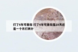 打了6年可善挺 打了6年可善挺是28天還是一個月打兩針