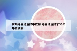 有喝綠豆湯治好牛皮癬 綠豆湯治好了30年牛皮頑癬