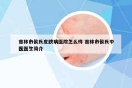 吉林市侯氏皮膚病醫(yī)院怎么樣 吉林市侯氏中醫(yī)醫(yī)生簡介