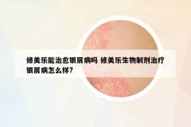 修美樂能治愈銀屑病嗎 修美樂生物制劑治療銀屑病怎么樣?