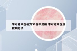李可老中醫(yī)名方30首牛皮癬 李可老中醫(yī)皮膚病方子
