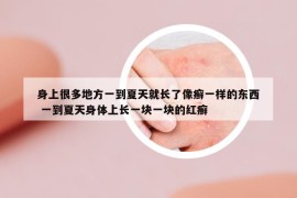 身上很多地方一到夏天就長了像癬一樣的東西 一到夏天身體上長一塊一塊的紅癬