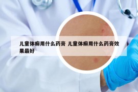 兒童體癬用什么藥膏 兒童體癬用什么藥膏效果最好