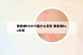 銀屑病PASI75是什么意思 銀屑病bsa分級(jí)