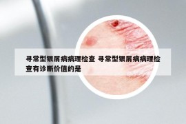 尋常型銀屑病病理檢查 尋常型銀屑病病理檢查有診斷價(jià)值的是