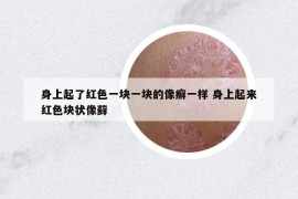 身上起了紅色一塊一塊的像癬一樣 身上起來紅色塊狀像蘚