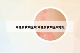 中北皮膚病醫(yī)院 中北皮膚病醫(yī)院地址
