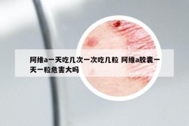 阿維a一天吃幾次一次吃幾粒 阿維a膠囊一天一粒危害大嗎