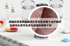 派瑞松軟膏和鹽酸特比萘芬乳膏哪個(gè)治療癬好 鹽酸特比萘芬乳膏與派瑞松呢哪個(gè)好