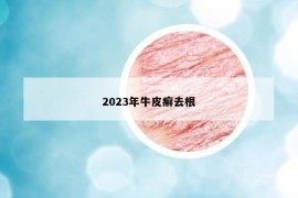2023年牛皮癬去根
