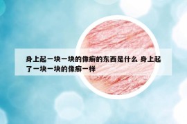 身上起一塊一塊的像癬的東西是什么 身上起了一塊一塊的像癬一樣