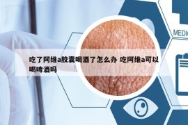 吃了阿維a膠囊喝酒了怎么辦 吃阿維a可以喝啤酒嗎