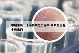 眼睛里有一個小白塊怎么回事 眼睛里面有一個白色的