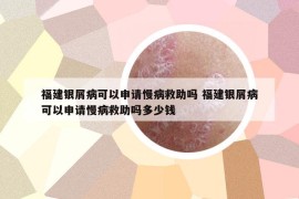 福建銀屑病可以申請慢病救助嗎 福建銀屑病可以申請慢病救助嗎多少錢
