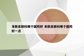 阜新皮膚科哪個醫(yī)院好 阜新皮膚科哪個醫(yī)院好一點