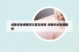 成都皮膚病醫(yī)院位置在哪里 成都的皮膚病醫(yī)院