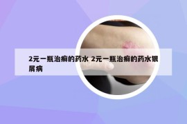 2元一瓶治癬的藥水 2元一瓶治癬的藥水銀屑病