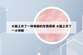 小腿上長了一塊像癬的東西很癢 小腿上長了一小塊癬