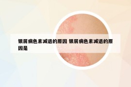 銀屑病色素減退的原因 銀屑病色素減退的原因是