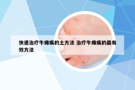 快速治療牛癱瘓的土方法 治療牛癱瘓的最有效方法