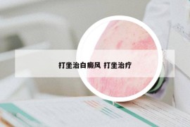 打坐治白癜風 打坐治療