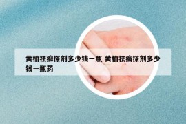 黃柏祛癬搽劑多少錢一瓶 黃柏祛癬搽劑多少錢一瓶藥