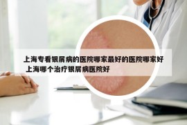 上海?？淬y屑病的醫(yī)院哪家最好的醫(yī)院哪家好 上海哪個(gè)治療銀屑病醫(yī)院好