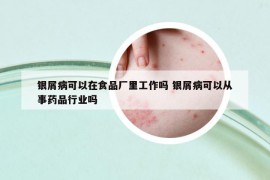 銀屑病可以在食品廠里工作嗎 銀屑病可以從事藥品行業(yè)嗎