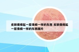 皮膚瘙癢起一層像癬一樣的東西 皮膚瘙癢起一層像癬一樣的東西圖片