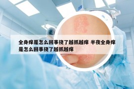全身癢是怎么回事?lián)狭嗽阶ピ桨W 半夜全身癢是怎么回事?lián)狭嗽阶ピ桨W