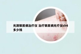 光源銀屑病治療儀 治療銀屑病光療儀sh4多少錢