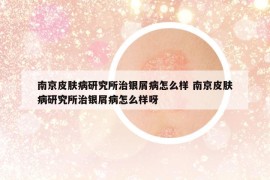 南京皮膚病研究所治銀屑病怎么樣 南京皮膚病研究所治銀屑病怎么樣呀