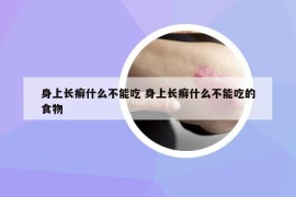 身上長癬什么不能吃 身上長癬什么不能吃的食物